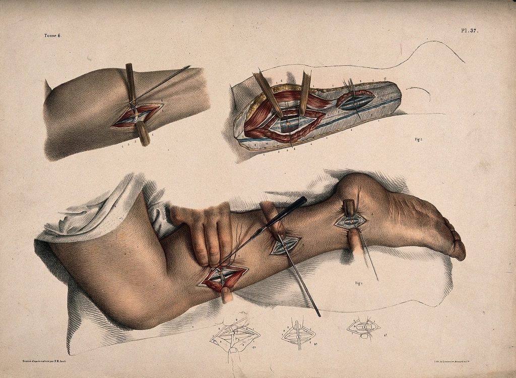 operation being performed leg ankle