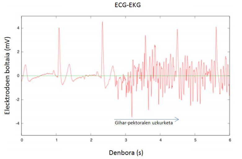 Ekg ecg