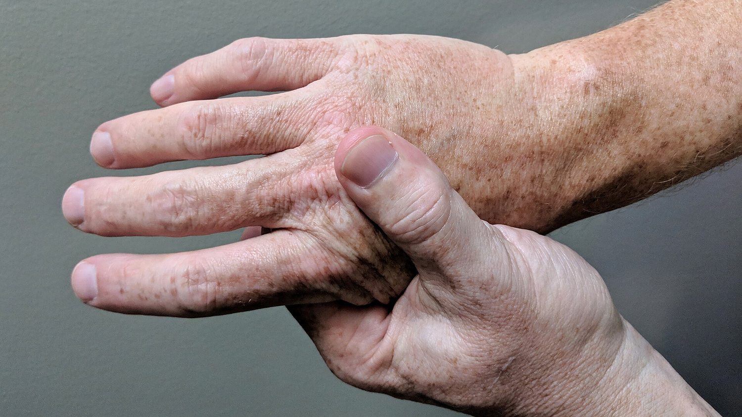 Arthritic hands in pain